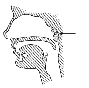 Adenoids removed facts