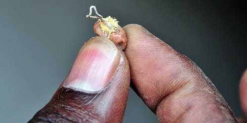 Safety Of Food And Recent Aflatoxin Scare In Europe