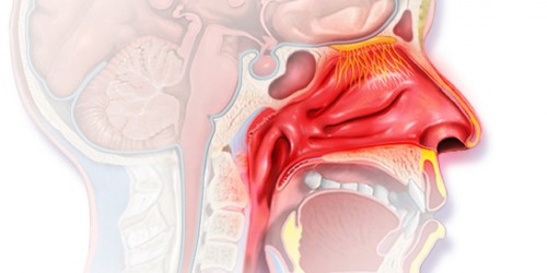 what-is-gustatory-rhinitis-general-center-steadyhealth