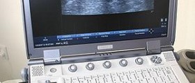 Amniocentesis for prenatal diagnosis
