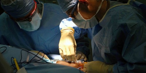 Chinese Doctors Save Man's Hand By Attaching It To Ankle