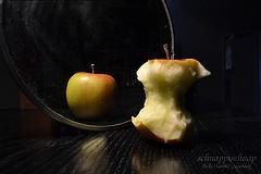 Anorexia nervosa - Signs and symptoms