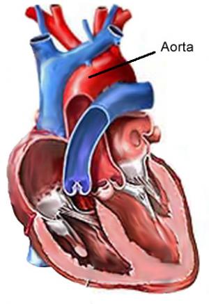 Aortic valve replacement