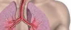 Asthma herbal remedy