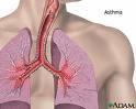 Asthma symptoms in adults