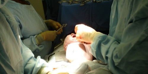 Cesarean Vs Vaginal Delivery: Get The Facts Right