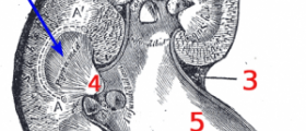 Back pain symptoms of kidney disease