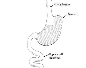 Bacterial infection in stomach | General center ...