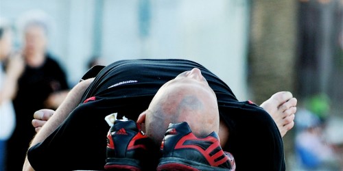 Treatment of Baldness: The Cure for Hair Loss Accidentally Found