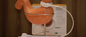 Bariatric Surgery Should Not Be The Last Resort