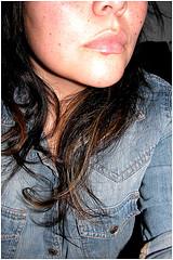 Basic and useful information on fever blisters