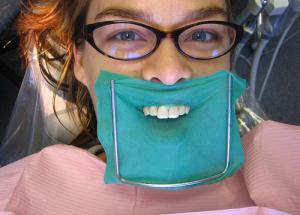 Basic dental care