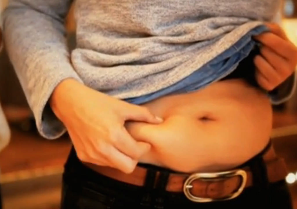 stomach stapled weight loss