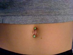 Belly button ring infection