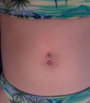 Belly button surgery