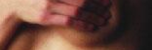Benign cyst in breast