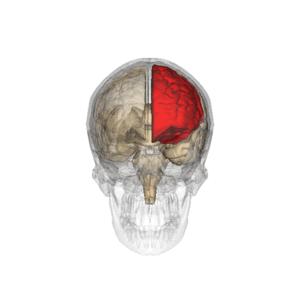 Benign frontal epilepsy
