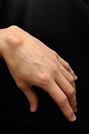 Benign ganglion cyst