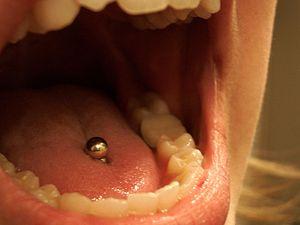 Benign mouth tumor | General center | SteadyHealth.com