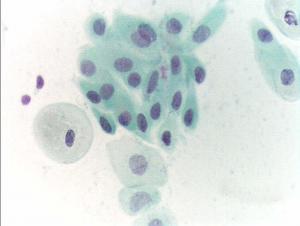 light bleeding after pap test