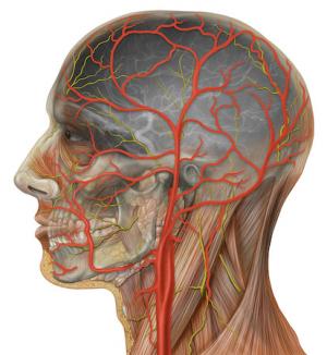 Blocked arteries in neck | General center | SteadyHealth.com