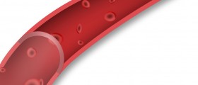 Autoimmune Hemolytic Anemia: An Autoimmune Disorder that can Damage Your Heart