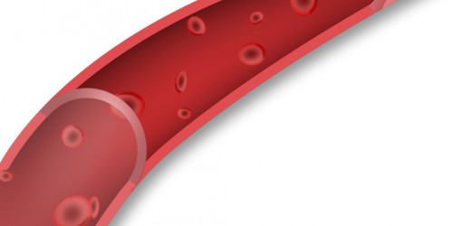 Autoimmune Hemolytic Anemia: An Autoimmune Disorder that can Damage Your Heart