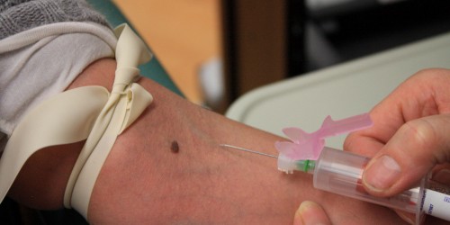 Can A Simple Blood Test Detect Cancer?