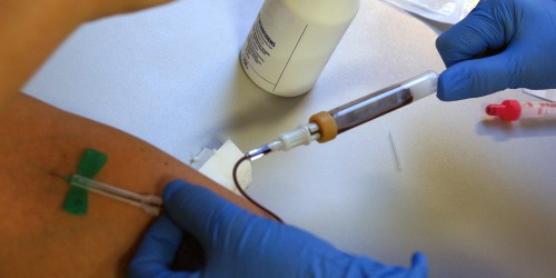 Aging And The Mystery Of "Young Blood"