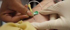 Lovastatin: The First Approved Plasma Cholesterol Inhibitor