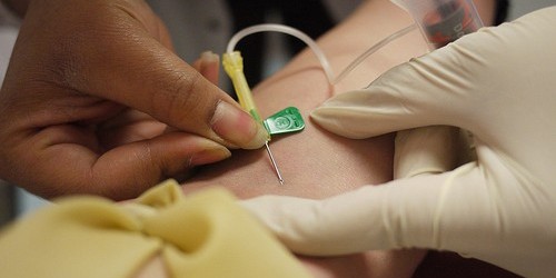 Lovastatin: The First Approved Plasma Cholesterol Inhibitor