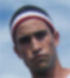 Blurred vision in one eye