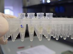 Body infection: E coli in the blood