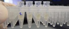 Body infection: E coli in the blood