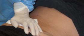 Bone Cancer Treatments, Symptoms, Risks and Prevention Tips
