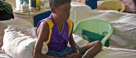 Leprosy - Unfinished Story