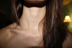 Broken clavicle