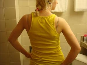 Burning upper back pain