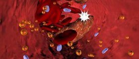 Calcium hardening arteries