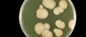 Can fasting cause a candida die-off?