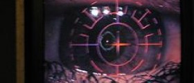 Care after Lasik eye surgery