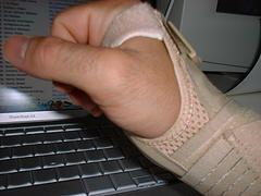 Carpal tunnel treatment