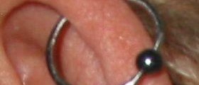 Cartilage piercing bump