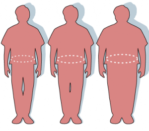 Causes of obesity in America