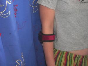 Causes of tennis elbow