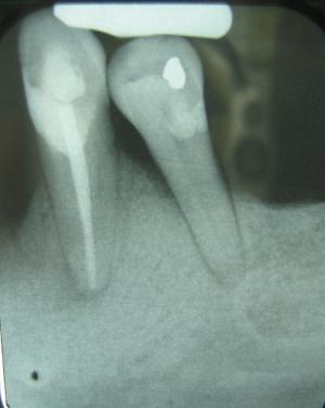 Causes, symptoms and treatment for periodontal disease