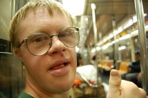 Characteristics of down syndrome