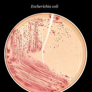 what is e coli caused from