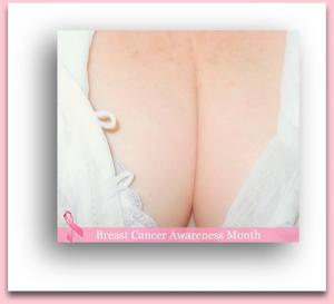 Chemotherapy before surgery for breast cancer