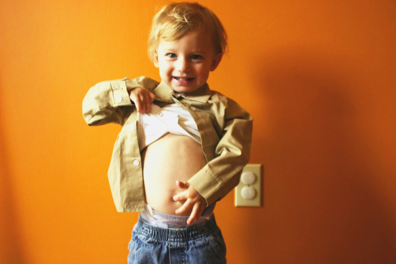 How To Recognize An Umbilical Hernia? Children's & Teens Health